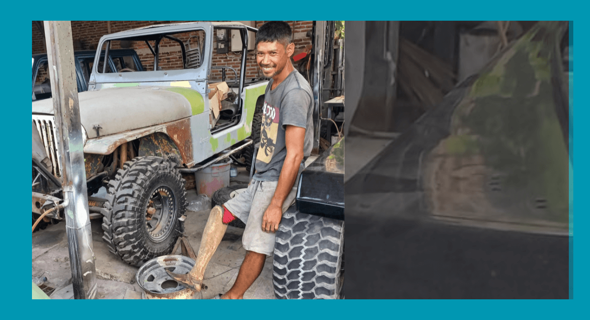 Kisah Johan : Kaki Diamputasi Akibat Digigit Ular,  Tak Surut Bela Keluarga di Pandeglang-Banten