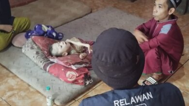 Anak Gizi Buruk di Cibatung Pandeglang Kondisinya Memprihatinkan