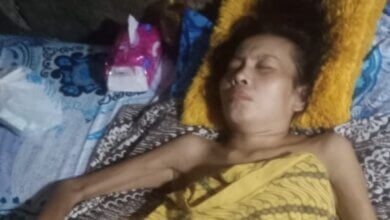 Memprihatinkan, Pasien Kanker di Kota Serang Tak Punya Biaya untuk Berobat